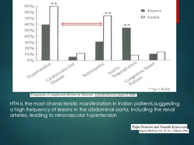 HTN is the most characteristic manifestation in Indian patients,suggesting a