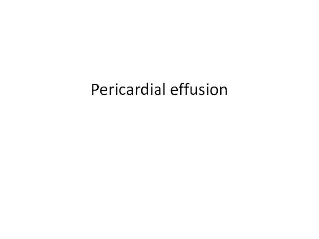 Pericardial effusion