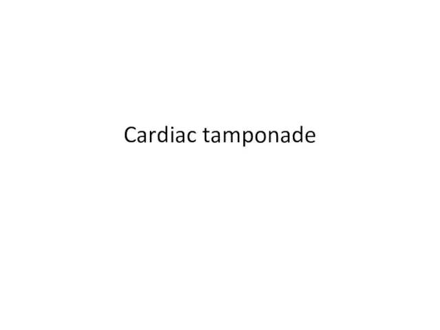 Cardiac tamponade