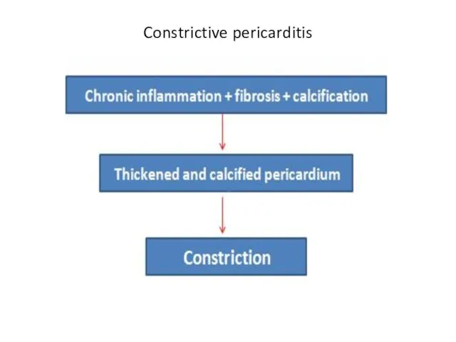 Constrictive pericarditis