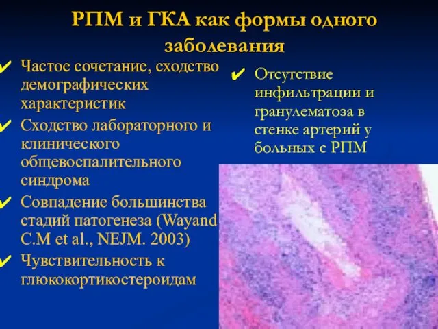 РПМ и ГКА как формы одного заболевания Частое сочетание, сходство