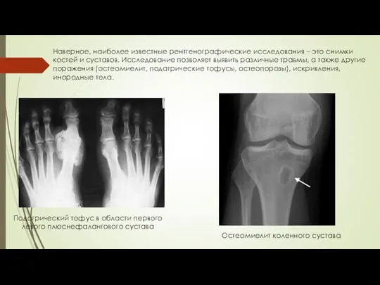 Наверное, наиболее известные рентгенографические исследования – это снимки костей и суставов. Исследование позволяет