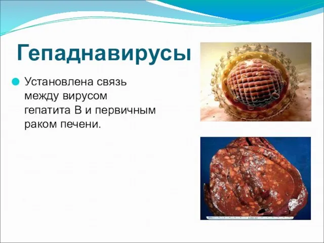 Гепаднавирусы Установлена связь между вирусом гепатита В и первичным раком печени.