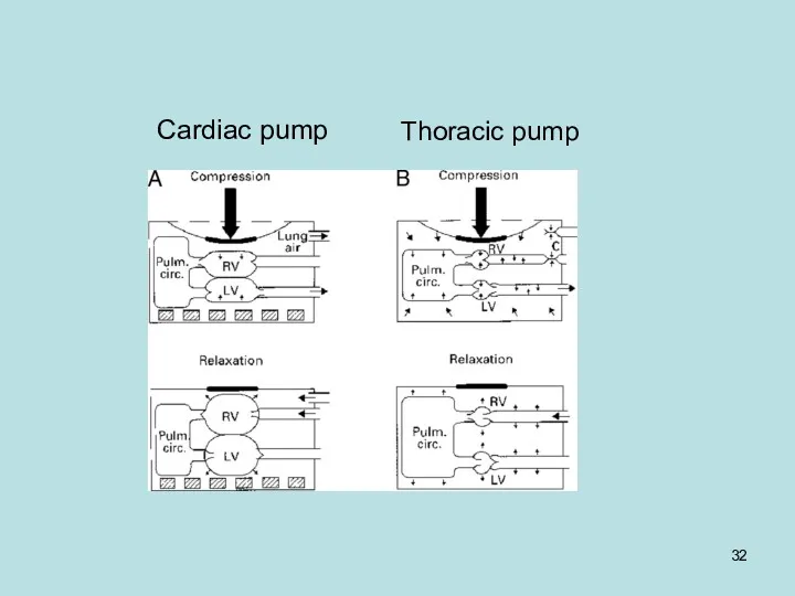 Thoracic pump Cardiac pump