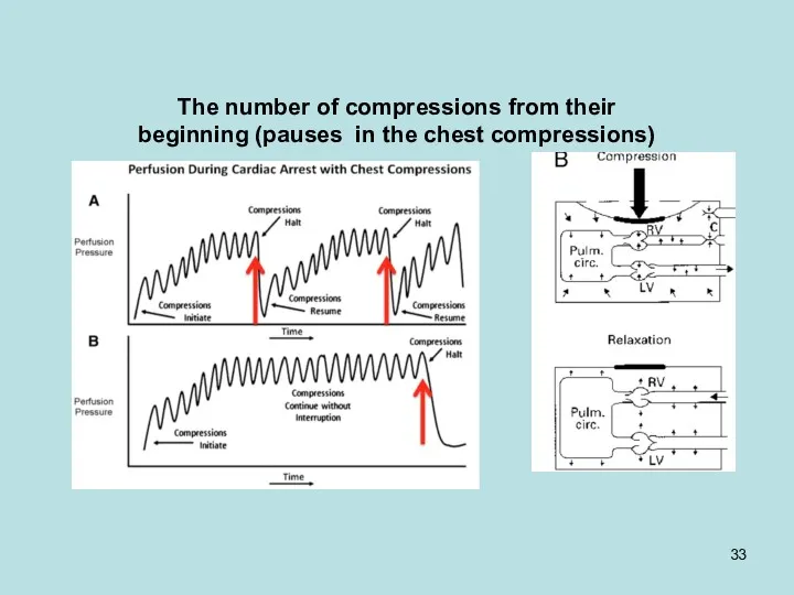 The number of compressions from their beginning (pauses in the chest compressions)