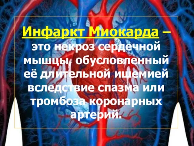 Инфаркт Миокарда – это некроз сердечной мышцы, обусловленный её длительной