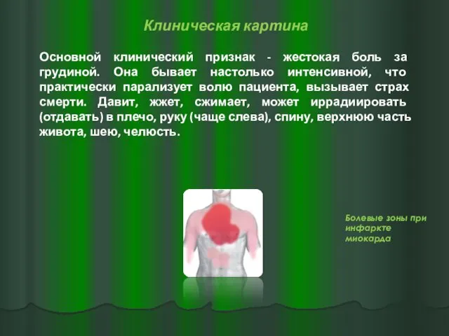 Клиническая картина Основной клинический признак - жестокая боль за грудиной.