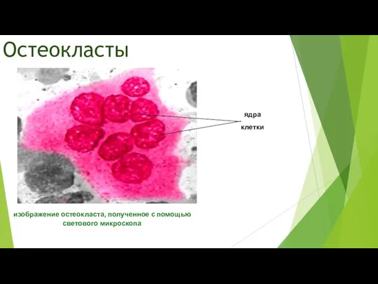 Остеокласты изображение остеокласта, полученное с помощью светового микроскопа ядра клетки