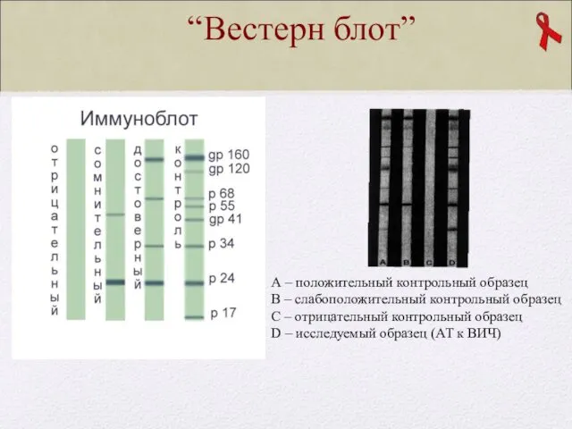 А – положительный контрольный образец В – слабоположительный контрольный образец