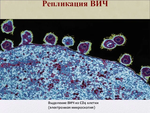 Репликация ВИЧ Выделение ВИЧ из CD4 клетки (электронная микроскопия)