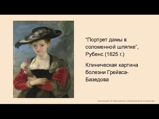 Цикл лекций Г.А. Мельниченко «Эндокринология в искусстве» “Портрет дамы в