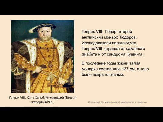Цикл лекций Г.А. Мельниченко «Эндокринология в искусстве» Генрих VIII, Ханс