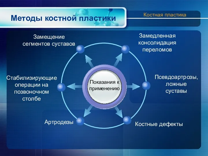 Методы костной пластики Показания к применению Замедленная консолидация переломов Замещение