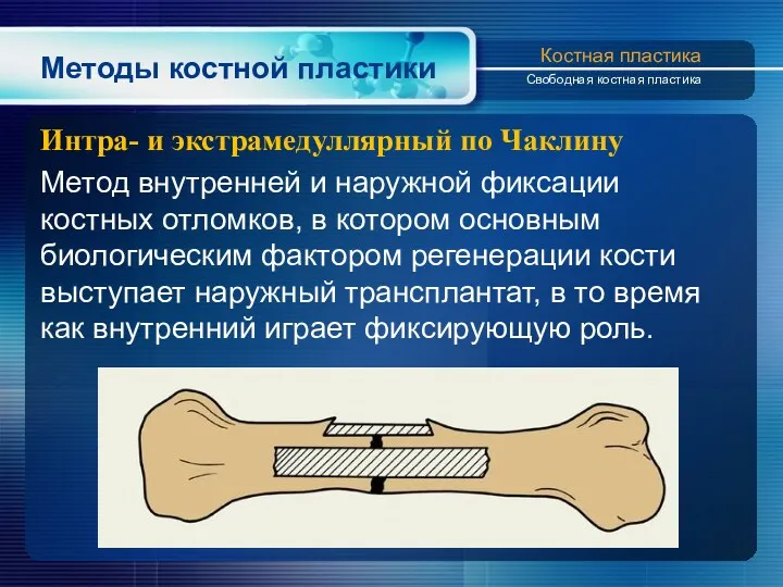 Методы костной пластики Интра- и экстрамедуллярный по Чаклину Метод внутренней