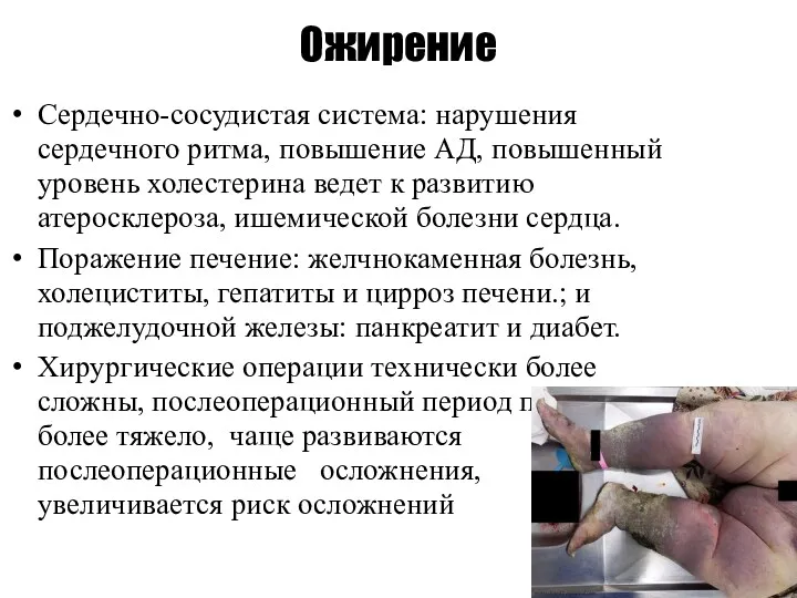 Ожирение Сердечно-сосудистая система: нарушения сердечного ритма, повышение АД, повышенный уровень