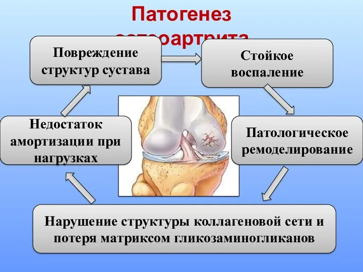 Патогенез остеоартрита Повреждение структур сустава Стойкое воспаление Патологическое ремоделирование Нарушение