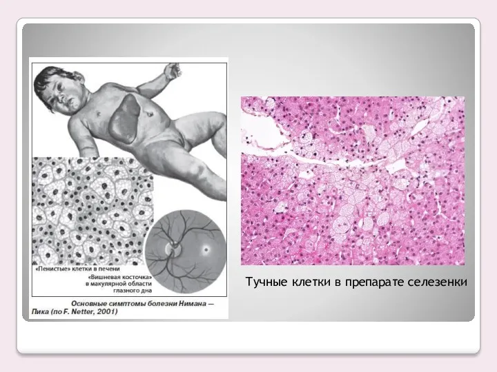 Тучные клетки в препарате селезенки