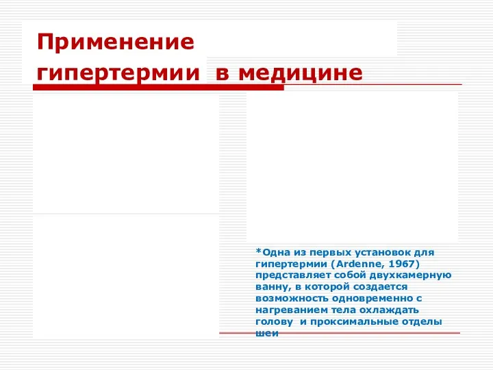 Применение гипертермии в медицине *Одна из первых установок для гипертермии