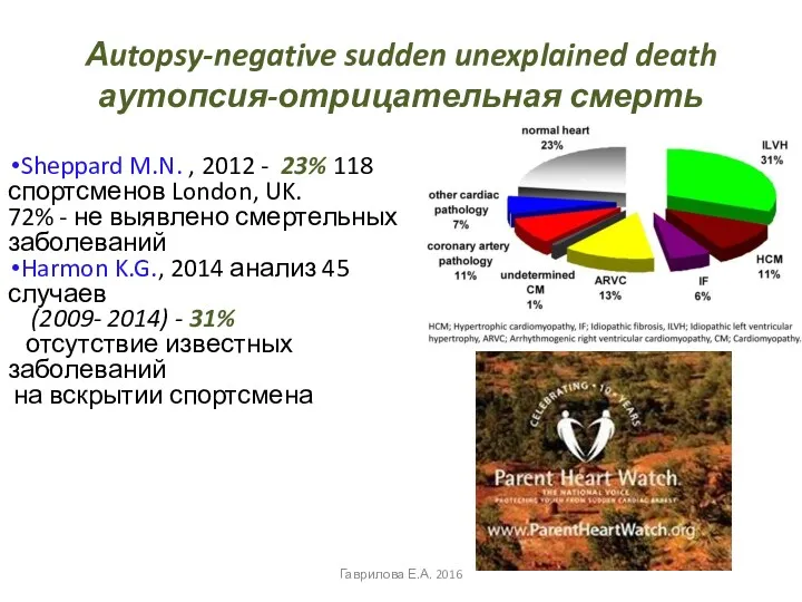 Аutopsy-negative sudden unexplained death аутопсия-отрицательная смерть Sheppard M.N. , 2012