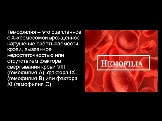 Гемофилия – это сцепленное с Х-хромосомой врожденное нарушение свёртываемости крови,