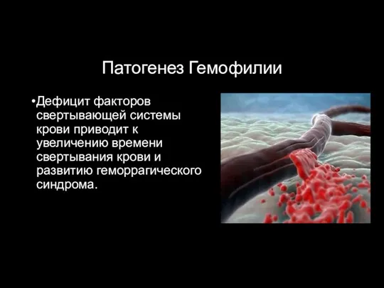 Патогенез Гемофилии Дефицит факторов свертывающей системы крови приводит к увеличению