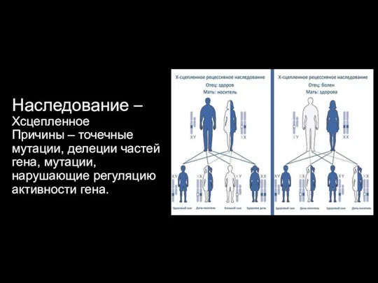 Наследование – Хсцепленное Причины – точечные мутации, делеции частей гена, мутации, нарушающие регуляцию активности гена.