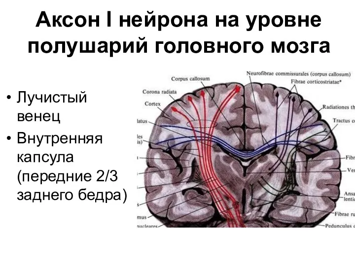 Аксон I нейрона на уровне полушарий головного мозга Лучистый венец Внутренняя капсула (передние 2/3 заднего бедра)