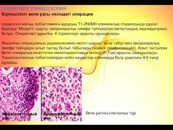 ОПЕРАТИВТІ ТОРАКОСКОПИЯ Біріншілікті өкпе рагы кезіндегі операция торакоскопиялық лобэктомияға аурудың