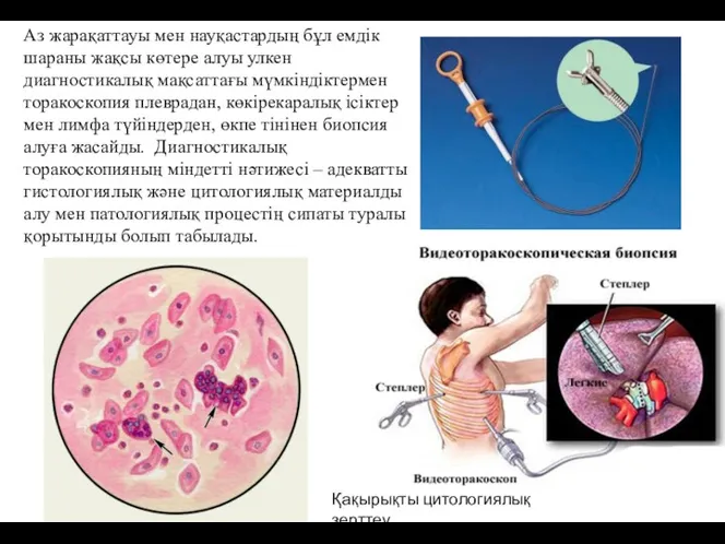 Аз жарақаттауы мен науқастардың бұл емдік шараны жақсы көтере алуы