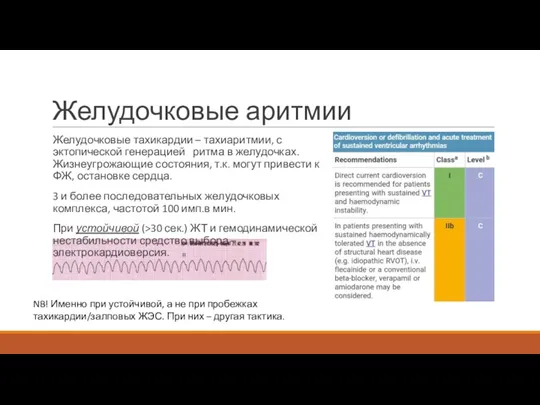 Желудочковые аритмии Желудочковые тахикардии – тахиаритмии, с эктопической генерацией ритма