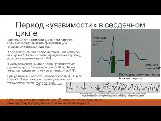 Период «уязвимости» в сердечном цикле Электрическая стимуляция в этом отрезке