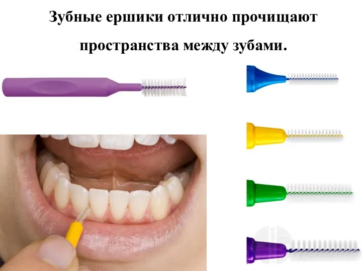 Зубные ершики отлично прочищают пространства между зубами.