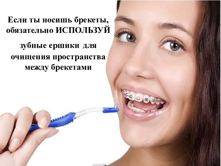 Если ты носишь брекеты, обязательно ИСПОЛЬЗУЙ зубные ершики для очищения пространства между брекетами