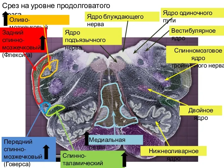 Срез на уровне продолговатого мозга Ядро блуждающего нерва Ядро подъязычного