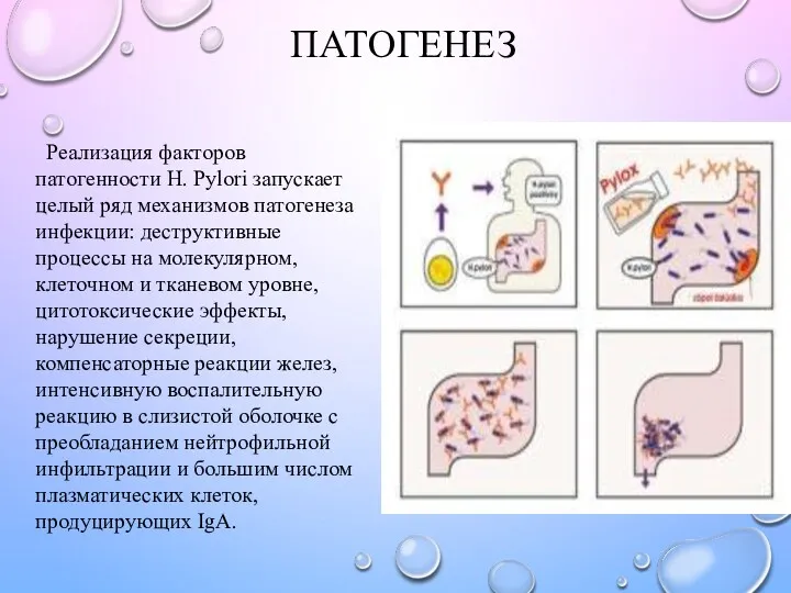 ПАТОГЕНЕЗ Реализация факторов патогенности H. Pylori запускает целый ряд механизмов