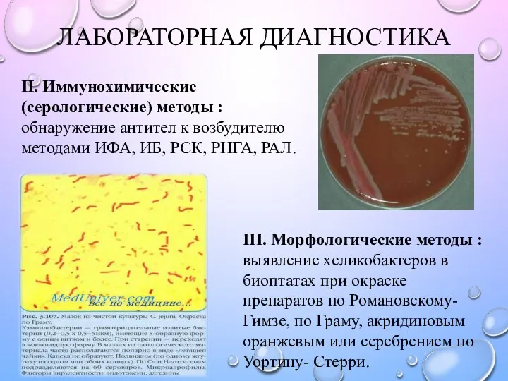 ЛАБОРАТОРНАЯ ДИАГНОСТИКА II. Иммунохимические (серологические) методы : обнаружение антител к