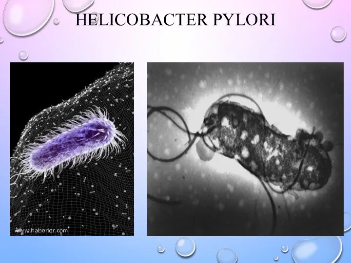 HELICOBACTER PYLORI