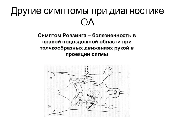 Другие симптомы при диагностике ОА