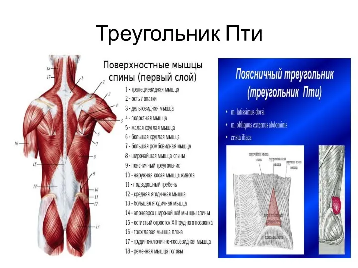 Треугольник Пти