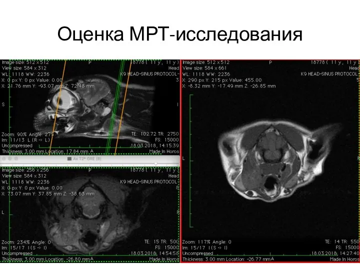 Оценка МРТ-исследования