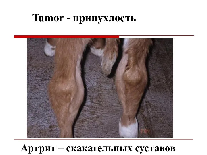 Tumor - припухлость Артрит – скакательных суставов