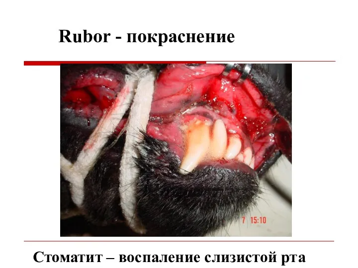 Rubor - покраснение Стоматит – воспаление слизистой рта