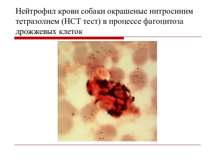Нейтрофил крови собаки окрашеные нитросиним тетразолием (НСТ тест) в процессе фагоцитоза дрожжевых клеток