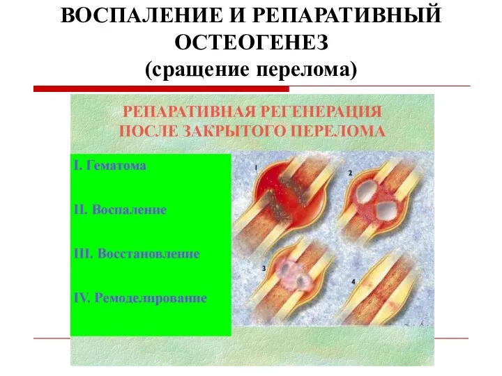 ВОСПАЛЕНИЕ И РЕПАРАТИВНЫЙ ОСТЕОГЕНЕЗ (сращение перелома)