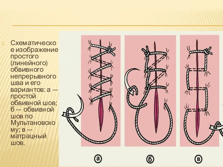 Схематическое изображение простого (линейного) обвивного непрерывного шва и его вариантов: