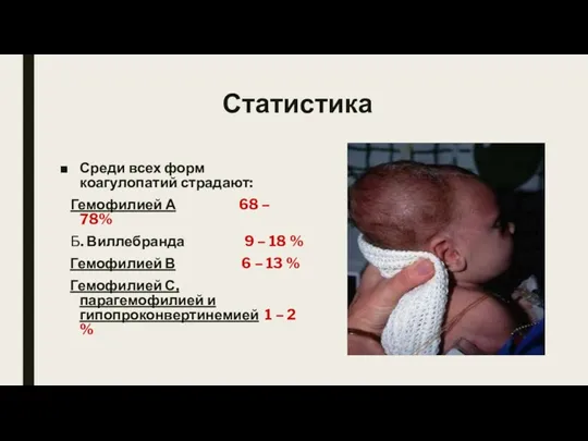 Статистика Среди всех форм коагулопатий страдают: Гемофилией А 68 – 78% Б. Виллебранда