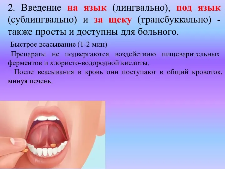 2. Введение на язык (лингвально), под язык (сублингвально) и за