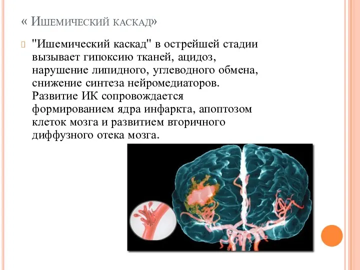 « Ишемический каскад» ''Ишемический каскад'' в острейшей стадии вызывает гипоксию