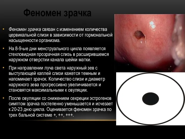 Феномен зрачка Феномен зрачка связан с изменением количества цервикальной слизи