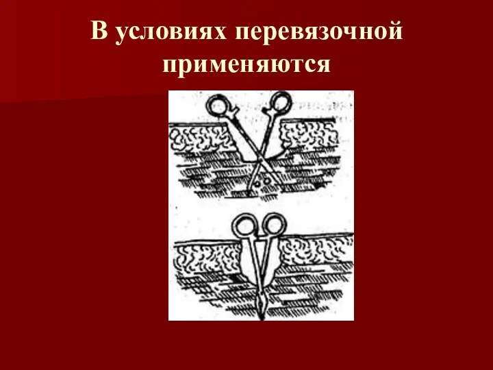 В условиях перевязочной применяются